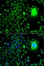 TAF5 Polyclonal Antibody