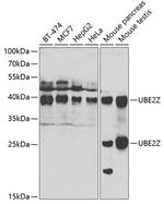 UBE2Z Polyclonal Antibody