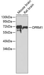 OPRM1 Antibody in Western Blot (WB)