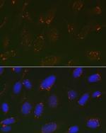 GOLPH2 Polyclonal Antibody