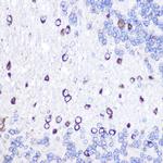 GOLPH2 Antibody in Immunohistochemistry (Paraffin) (IHC (P))