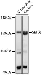SETD5 Antibody in Western Blot (WB)