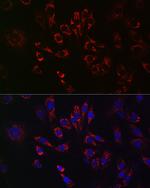 TFEB Polyclonal Antibody
