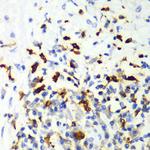 CAPG Polyclonal Antibody