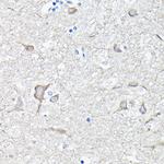EEF1A2 Antibody in Immunohistochemistry (Paraffin) (IHC (P))