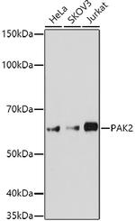 PAK2 Polyclonal Antibody