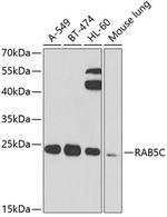 RAB5C Polyclonal Antibody