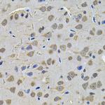 TGM1 Antibody in Immunohistochemistry (Paraffin) (IHC (P))