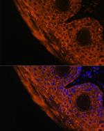TGM1 Antibody in Immunohistochemistry (IHC)
