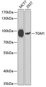 TGM1 Antibody in Western Blot (WB)