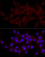 CALCOCO2 Polyclonal Antibody