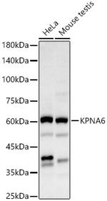 KPNA6 Polyclonal Antibody