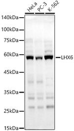 LHX6 Polyclonal Antibody