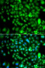 CSRP2BP Polyclonal Antibody