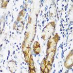 NAT15 Antibody in Immunohistochemistry (Paraffin) (IHC (P))