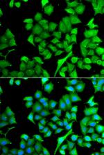 NAT13 Polyclonal Antibody