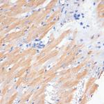PDCD2L Antibody in Immunohistochemistry (Paraffin) (IHC (P))