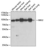 BBS2 Polyclonal Antibody