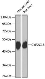 CYP2C18 Polyclonal Antibody