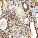NME2 Antibody in Immunohistochemistry (Paraffin) (IHC (P))
