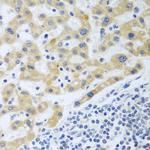 SHBG Polyclonal Antibody