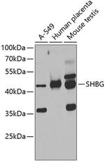 SHBG Antibody in Western Blot (WB)