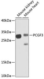 RNF3 Polyclonal Antibody