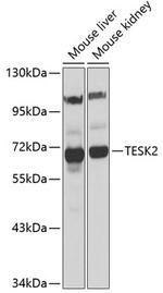 TESK2 Polyclonal Antibody