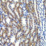 ZFAND3 Antibody in Immunohistochemistry (Paraffin) (IHC (P))
