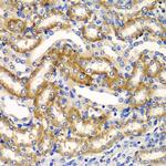 ZFAND3 Antibody in Immunohistochemistry (Paraffin) (IHC (P))
