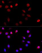 Tug Antibody in Immunocytochemistry (ICC/IF)