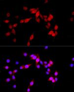 Tug Antibody in Immunocytochemistry (ICC/IF)