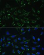 HCCS Polyclonal Antibody