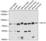 SP110 Polyclonal Antibody