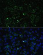 ALDH1A2 Antibody in Immunocytochemistry (ICC/IF)