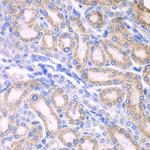 ALDH1A2 Antibody in Immunohistochemistry (Paraffin) (IHC (P))