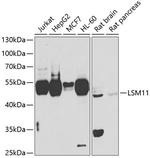 LSM11 Polyclonal Antibody