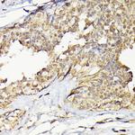 TRBP Antibody in Immunohistochemistry (Paraffin) (IHC (P))