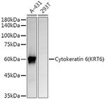Cytokeratin 6A Polyclonal Antibody