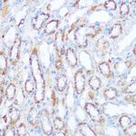 SIRT4 Polyclonal Antibody