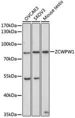 ZCWPW1 Polyclonal Antibody