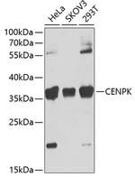 CENPK Polyclonal Antibody