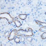 14-3-3 zeta Polyclonal Antibody
