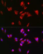 BAAT Polyclonal Antibody