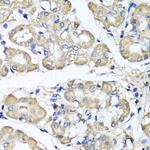 BCS1L Antibody in Immunohistochemistry (Paraffin) (IHC (P))