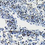 DRIL1 Antibody in Immunohistochemistry (Paraffin) (IHC (P))