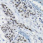 DRIL1 Polyclonal Antibody