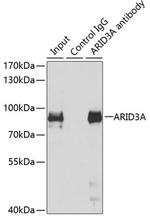DRIL1 Antibody in Immunoprecipitation (IP)