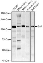 GAA Polyclonal Antibody