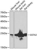 GSTA2 Polyclonal Antibody